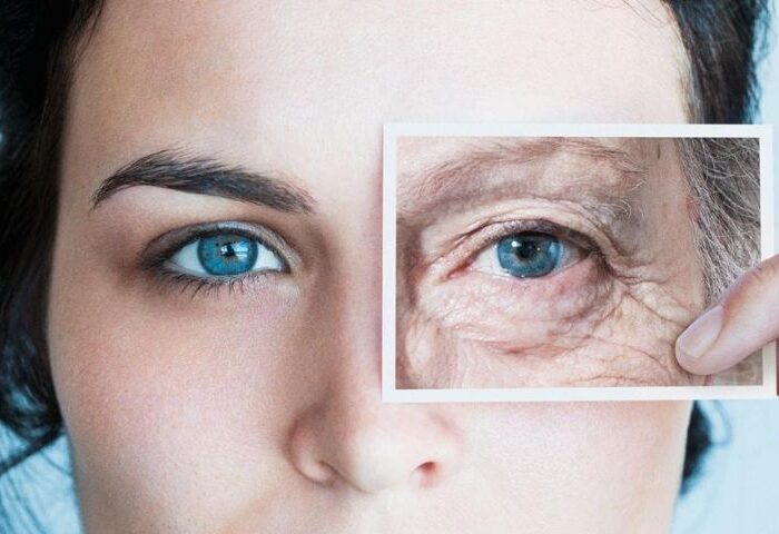 skin aging